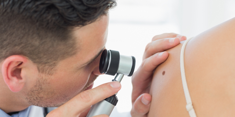 Introduction to Skin Lesion Identification and Dermatoscopy