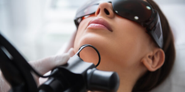 Laser Resurfacing