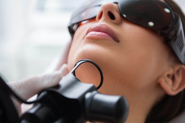 Laser Resurfacing